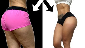 ¿Cómo combatir la flacidez de las piernas y glúteos?
