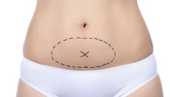 ¿Por qué se hace el vientre bajo?